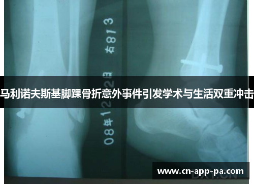 马利诺夫斯基脚踝骨折意外事件引发学术与生活双重冲击
